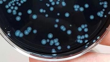 Foco de surto de ‘legionella’ em Caminha que causou um morto ficou por identificar