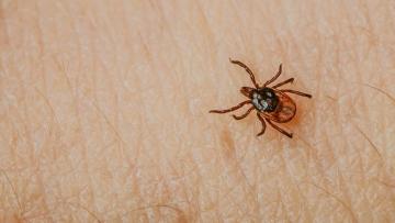 Confirmado primeiro caso e óbito de doente com Febre hemorrágica Crimeia-Congo