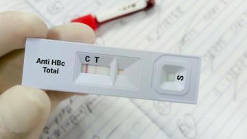 Sociedade Portuguesa apela a teste da hepatite C pelo menos uma vez na vida