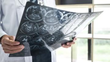 Técnicos superiores de diagnóstico e terapêutica iniciam greve de dois dias