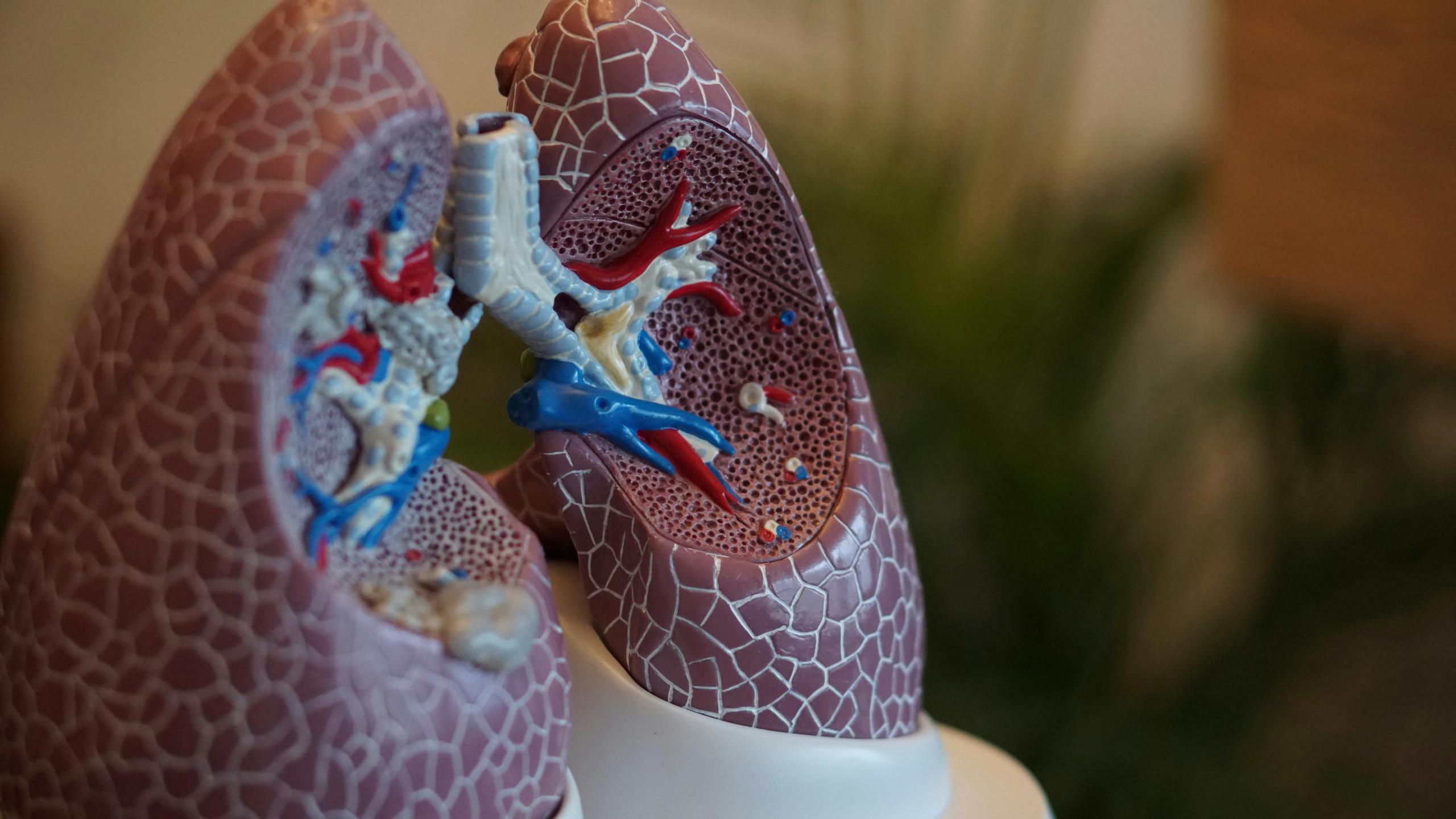 Transplante pulmonar deu uma "segunda vida" a 400 doentes em Portugal