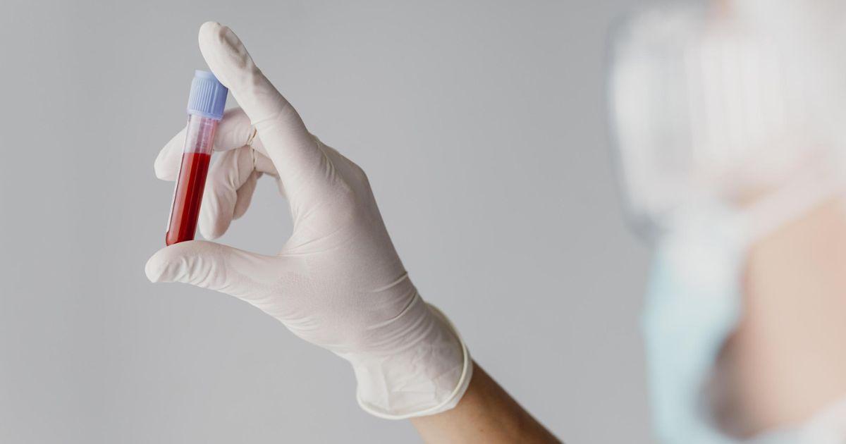 Dez projetos nas áreas do VIH, hepatites e cancro da mama recebem 300 mil euros